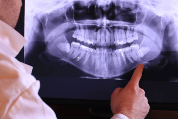 Best Emergency Treatment for Toothache in Blanco, TX