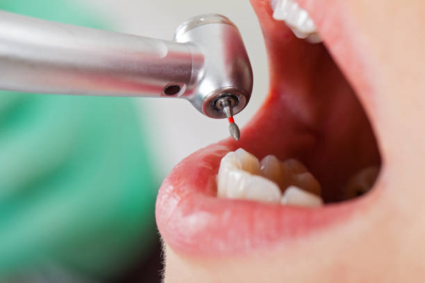 Best Emergency Treatment for Toothache in Blanco, TX